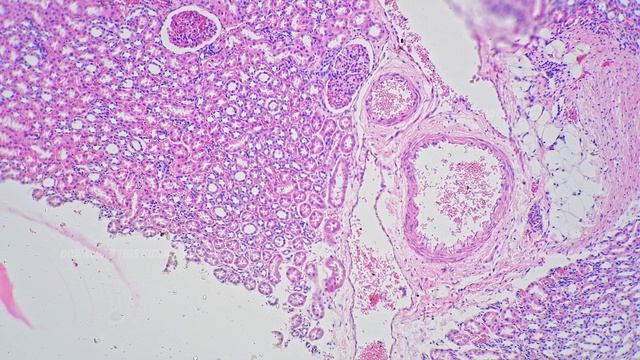 Artery And Vein In Section Magnified Under Microscope 100x Filmed On Bright Field