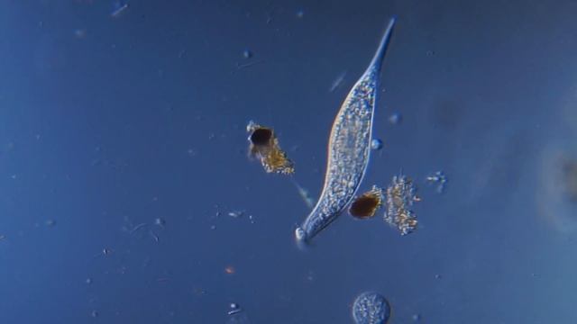 Инфузория (предположительно Amphileptus)