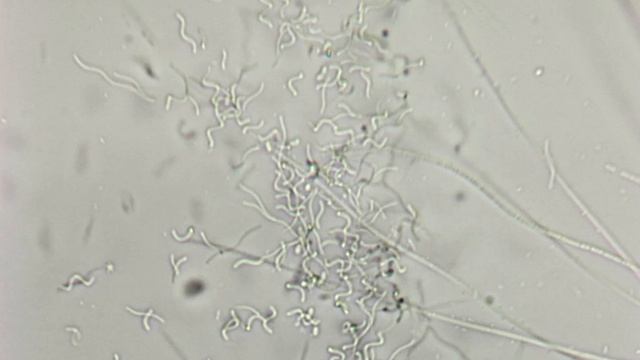 Спириллы и трихомы нитчатых цианобактерий