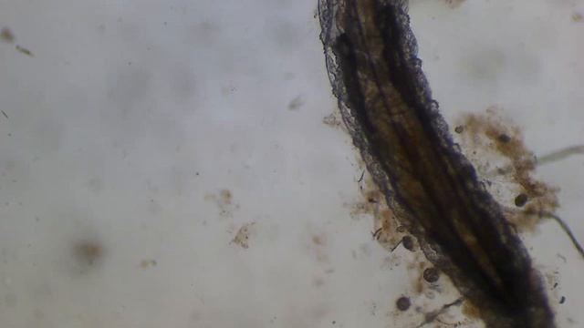 червь под микроскопом