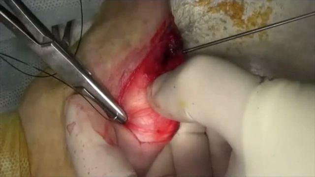 Хирургическое лечение медиального вывиха коленной чашки у собаки