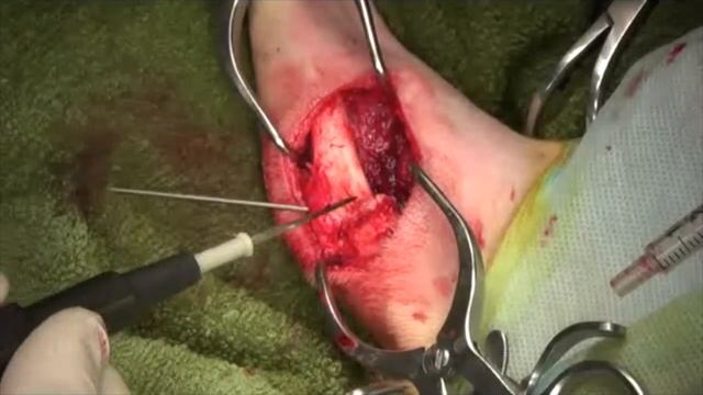 Хирургическое лечение разрыва ПКС у карликовых пород собак