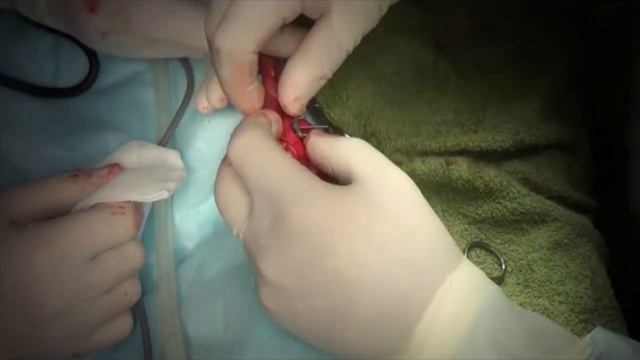 Хирургическое лечение медиального вывиха коленной чашки 4 степени у собаки