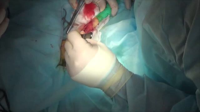 Хирургическое лечение тендогенной контрактуры скакательного сустава у кошки