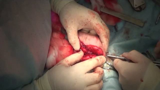 Хирургическое лечение несращения перелома бедренной кости у собак