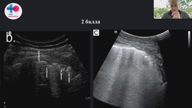 51ed31a1519fc76b09a82437947d081c