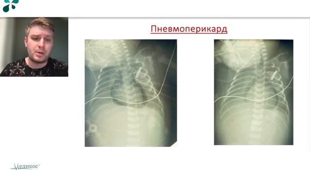 Новые технологии визуализации критических состояний в неонаталогии