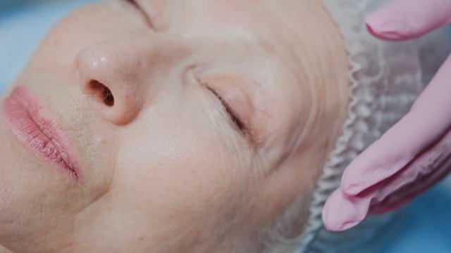 Смешай Вазелин и лимон и ты будешь в шоке! Уберёт ВСЕ МОРЩИНКИ   Mix Vaseline with Lemon
