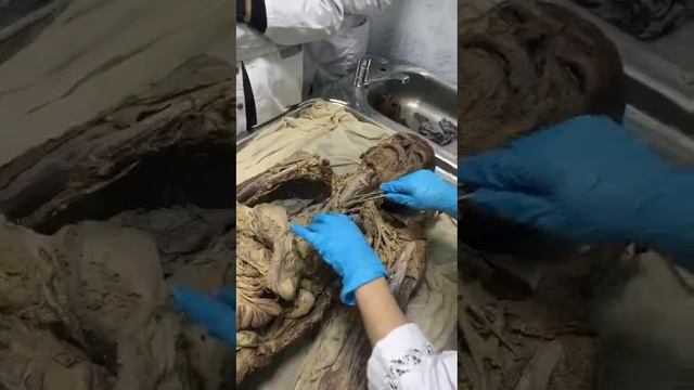 Медицина, вообразительное внутреннее строение человека.