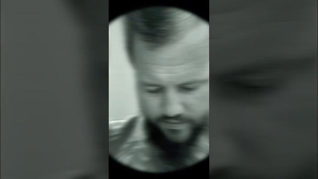 8th Month Of Hair Transplant | Healstetic #music #remix #newsong #cover #song #hairtransplant #dhi