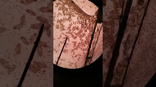 A52c3156d99dd5b21fe91810f34ca03a