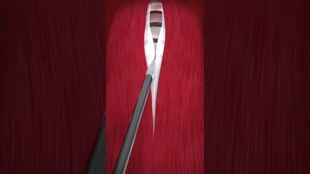 How Thyroid Gland Removed 3D Animation