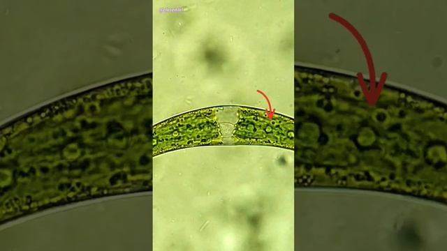 Closterium Algae Under Microscope (Mystery Vibrating Crystals)