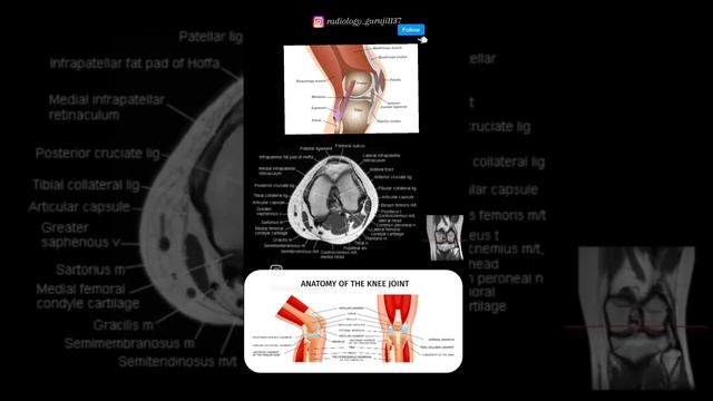 94c81329f704b74a7200f74d17b8a62d