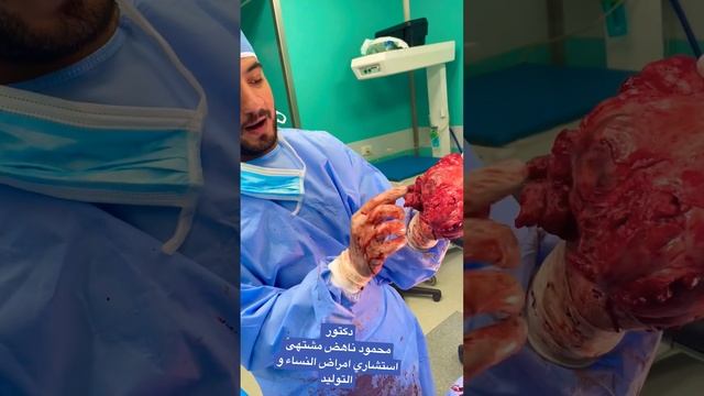#المشيمة_المتقدمه #المشيمه_الغائرة #المشيمه_الملتصقه #placentaprevia #أمراض_النساءوالتوليد