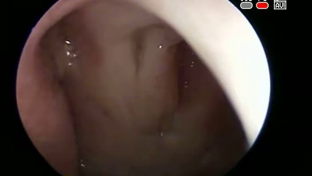 201606150938 5183