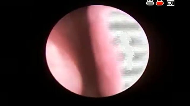 201703210443 3947