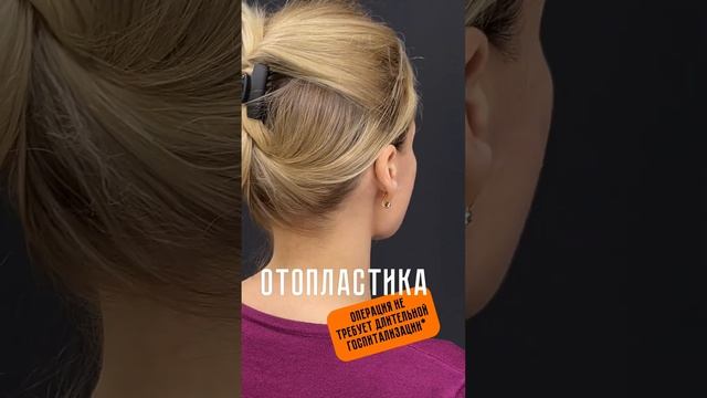 Отопластика.