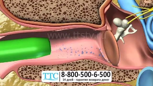 Прибор «Чистые ушки» (чистое ушко) Аппарат для домашней чистки ушей Ttstv Ru