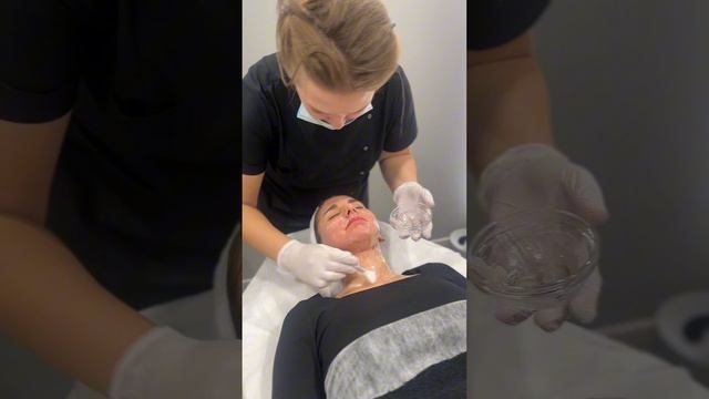 Пилинг. Процесс