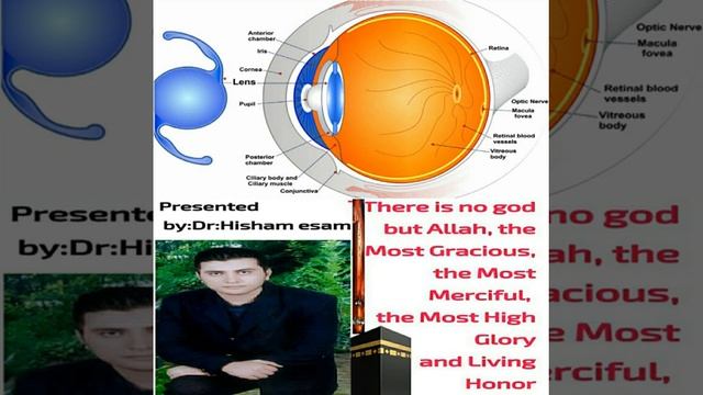 (Cataract Diagnosis and Treatment( fast female voice