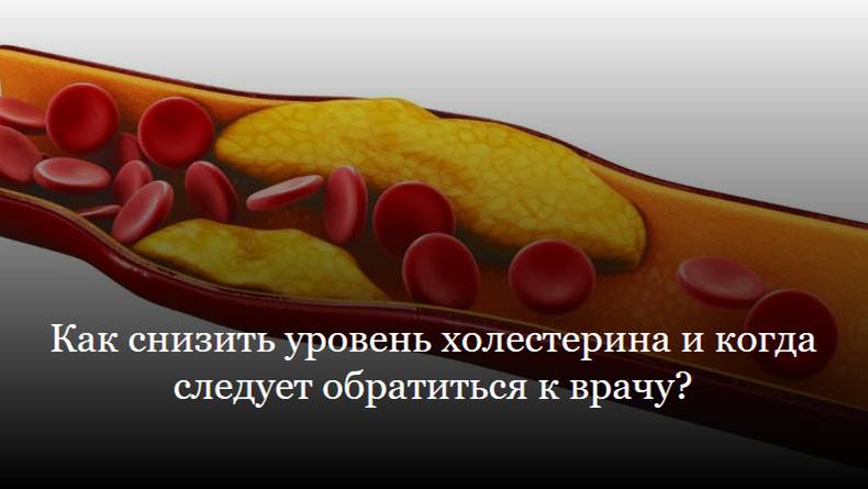 Как снизить уровень холестерина и когда следует обратиться к врачу?
