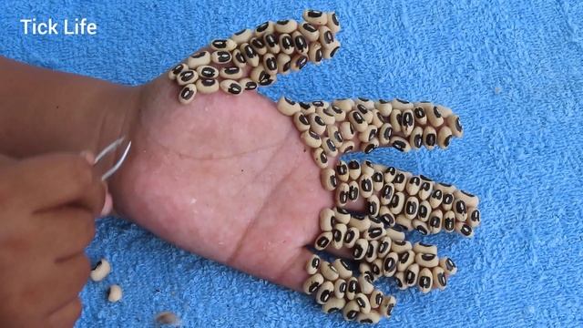 How To Remove Strange Ticks Style On Hand Poor Lady | Ticks Designed By Cereals #148