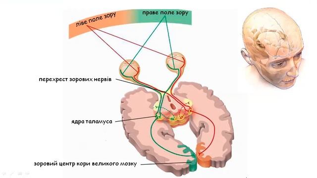 ЗІР ЛЮДИНИ  ПОРУШЕННЯ ЗОРУ