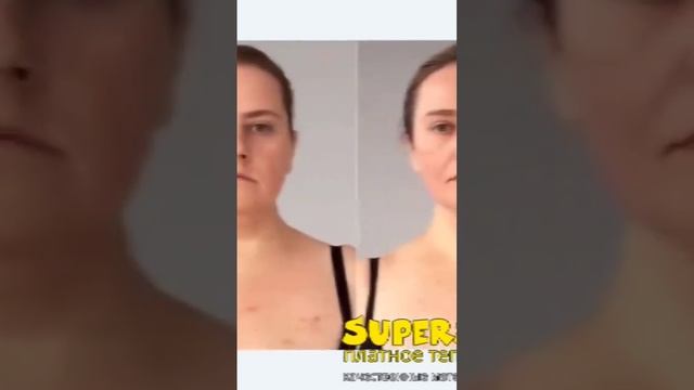 мышечный тонус