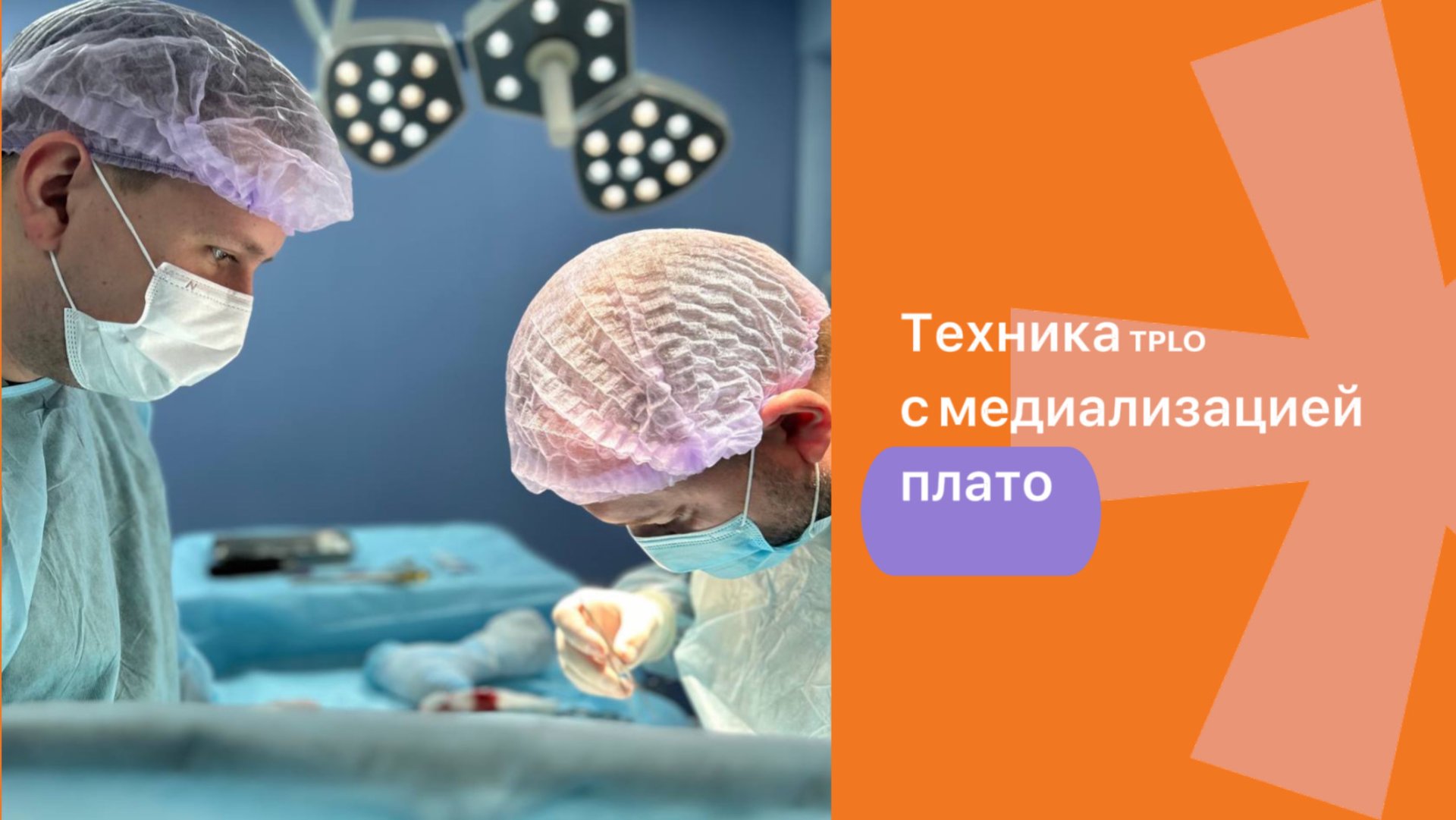 Техника TPLO с медиализацией плато
