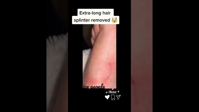 شعرة طويلة في القدم