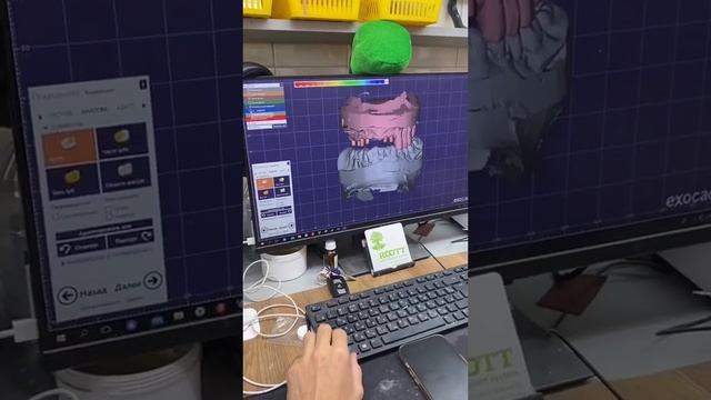 Чудеса нашей зуботехнической лаборатории 👍  Стоматология ROOTT