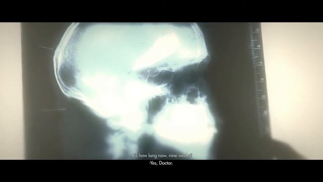 Lets Play Wolfenstein: The New Order (Xbox One) - Part 7