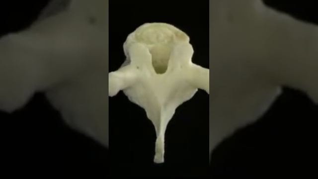 Позвоночник и межпозвонковые  диски.