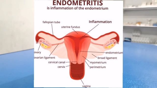 Uritrac Sachets #cranberry #Cranmax Use For UTI Or Utrus Infection Kidney Pain Or Blader Infection