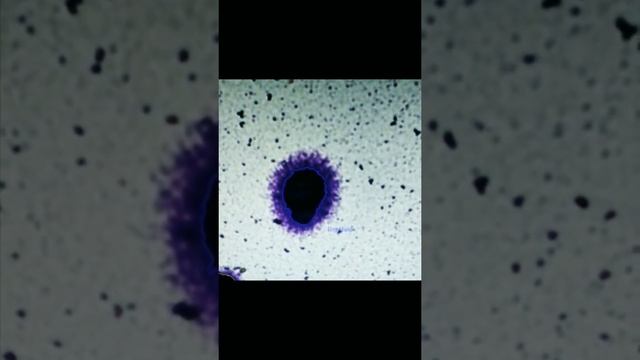 Microscopic Obervation Of Sperm DNA Fragmentation  (DFI Technique)