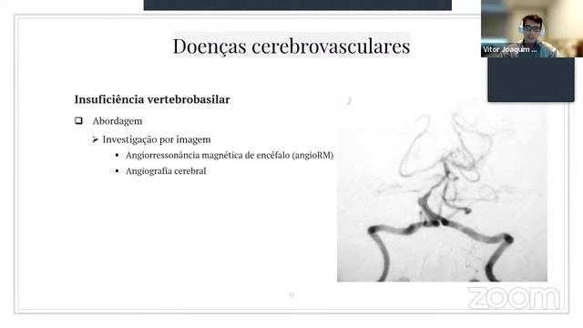 Reunião Do Setor De Neuroftalmologia 01 02 2022