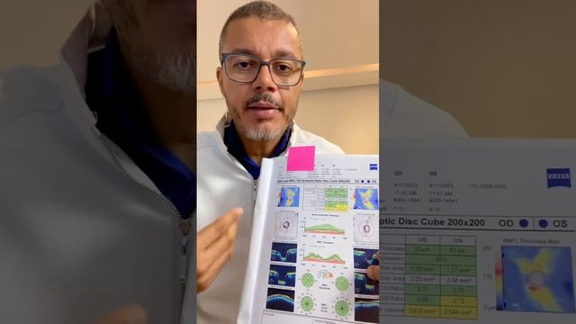 Como Um Procedimento A Laser Pode Afetar O Resultado Da OCT Glaucoma ￼