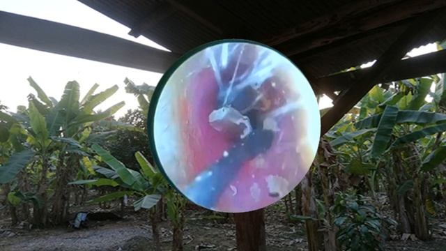 Ear Wax Removal Eps#247 || чистка ушной серы #247