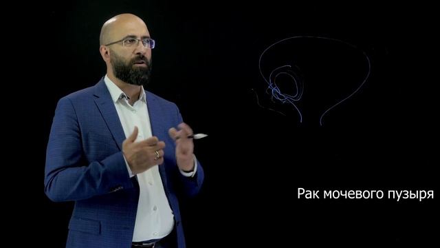 Рак мочевого пузыря | ОГАНЕС ДИЛАНЯН О ТЯЖЕЛОМ ДИАГНОЗЕ