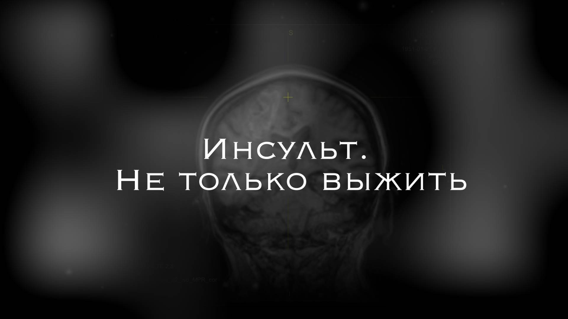 Инсульт. Не только выжить (Документальный фильм)