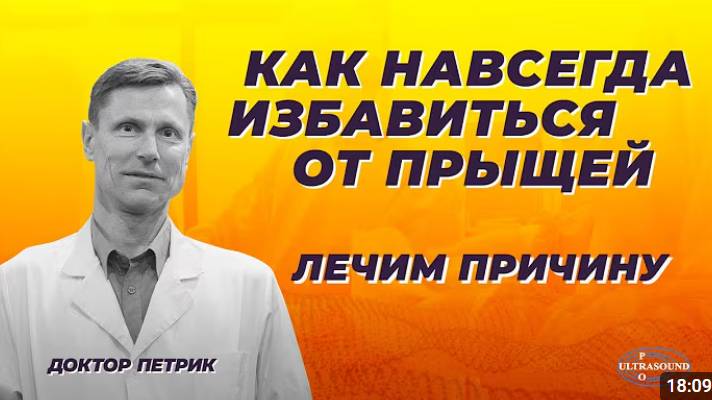 Как избавиться от прыщей. Лечим причину.