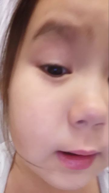 у меня опух глаз 👍🏻