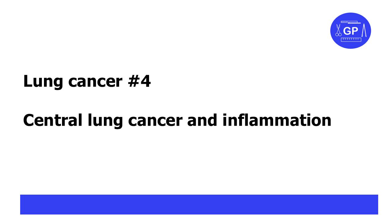 Lung Cancer #4 - сentral Lung Cancer And Pneumonitis (pneumonia)