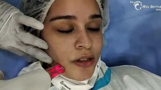 Episode 3: #DrVidushiSingal #Skincare & #Antiageing Journey: Fractional #Rejuvenation #LaserFacial