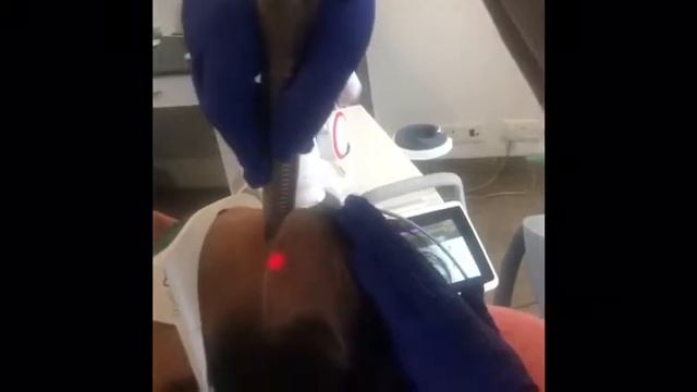 Advanced Laser Treatment For Hair Loss. Manya Aesthetic Clinic. Call @ 7799888879