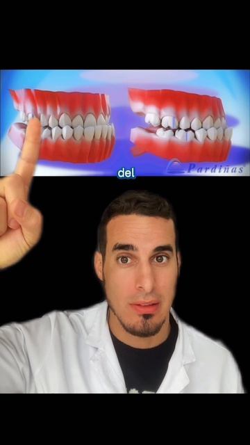 Así Se Ve Un MORDIDA INVERTIDA - Mandíbula Con MALOCLUSIÓN Clase III