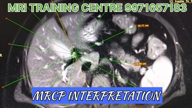 MRCP PLANNING INTERPRETATION, SEQUENCE, ANATOMY, PATHOLOGY