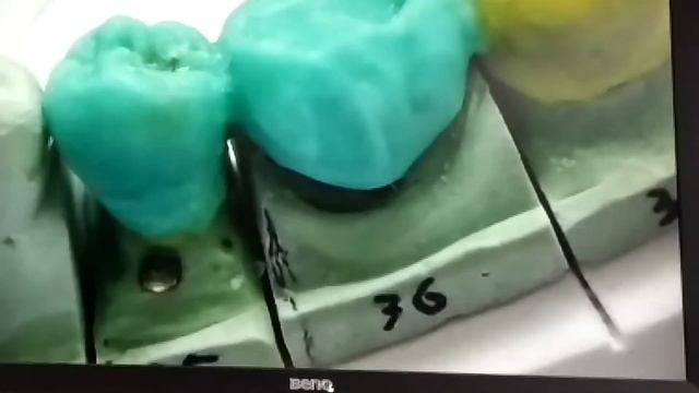 A5b3b58ddb9aa5e075aaa4c7ffbca684