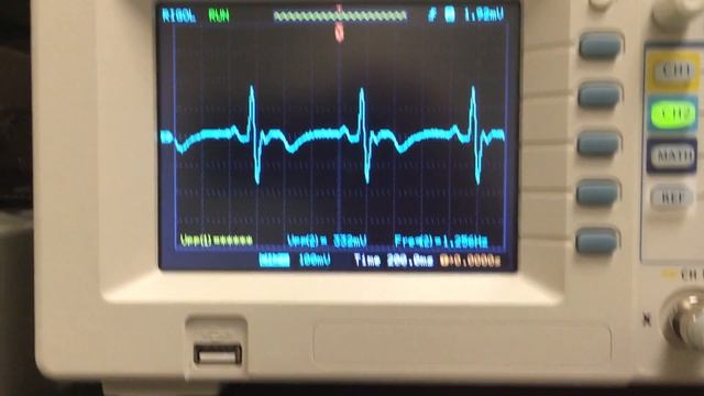 EKG Heartbeat Amplifier